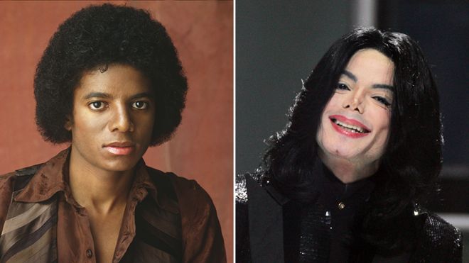 Michael Jackson Nose